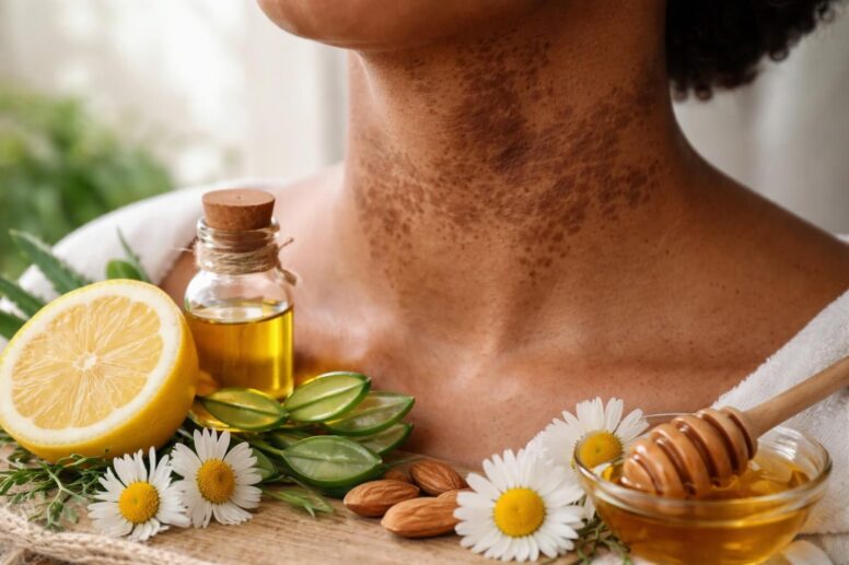 découvrez les remèdes naturels efficaces pour éliminer les taches brunes ou noires sur le cou. apprenez ce que vous devez savoir pour retrouver une peau éclatante et uniforme.