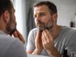 découvrez des conseils pratiques pour gérer la pelade de barbe, lutter contre les zones clairsemées et retrouver une barbe uniforme et dense.